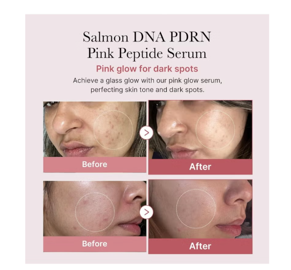 Salmon DNA PDRN Pink Peptide Serum, Pink glow serum, Peptide, Niacinamide, Hydrating & Moisturizing & Firming, Uneven Skin Tone, Korean Skincare | 1.01 fl.oz. (1.01 fl.oz., Salmon DNA PDRN)